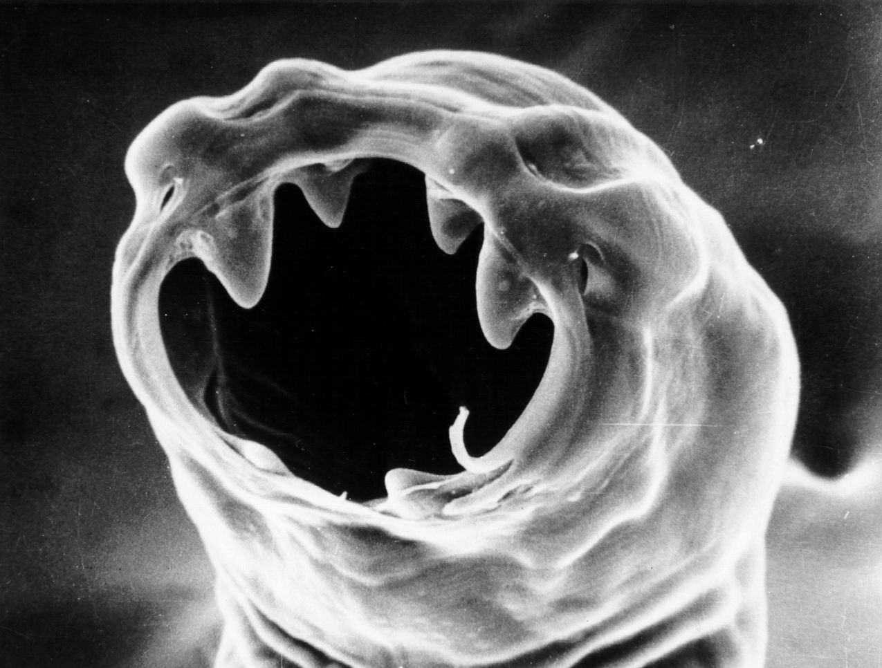  p>十二指肠钩口线虫(ancylostoma duodenale),简称为十二指肠钩虫,寄