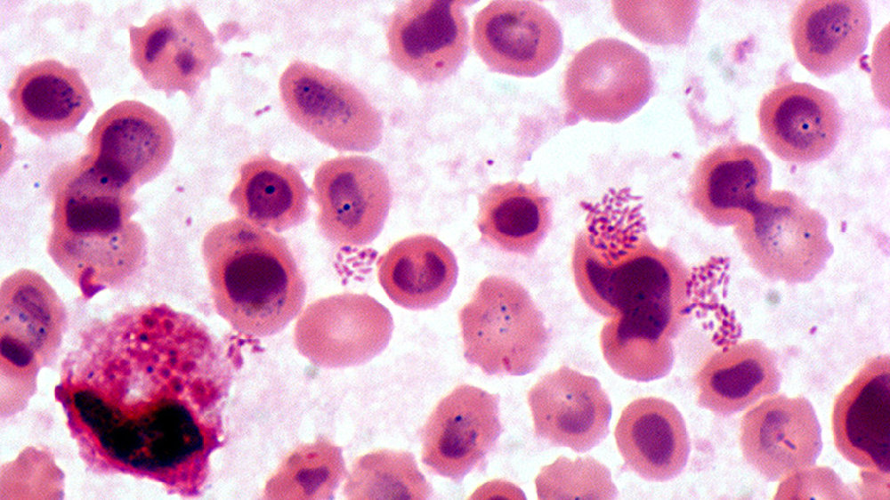  p> a href="#" data-lemmaid="10072121">布鲁氏杆菌 /a>(brucella)